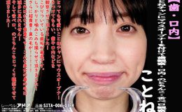 【HD】【歯・口内】大人気美女ことねチャンのマウスオープナーを付けて歯観察・口内・のどちんこ・舌ベロ観察!ことね